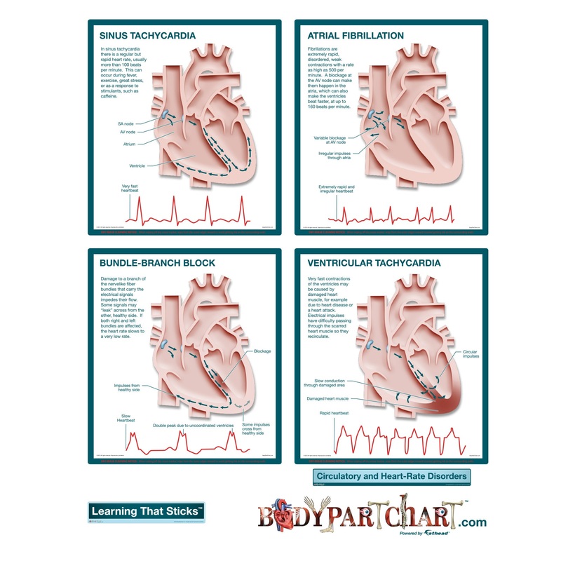 Body Part Chart:  Circulatory and Heart Rate Disorders        –   Removable     Adhesive Decal