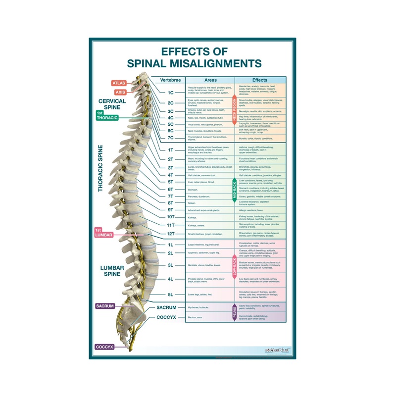 Body Part Chart:  Effects of Spinal Misalignments Sign        –   Removable     Adhesive Decal