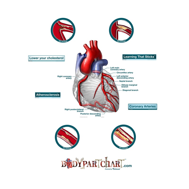 Body Part Chart:  Heart and Coronary Arteries        –   Removable     Adhesive Decal