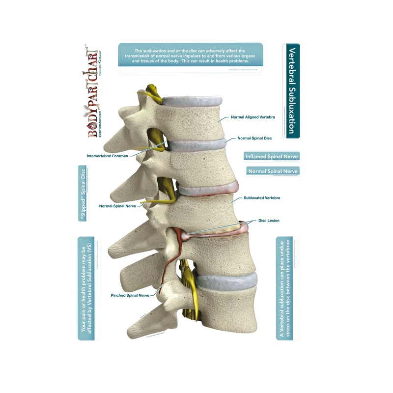 Body Part Chart:  Subluxation        –   Removable     Adhesive Decal